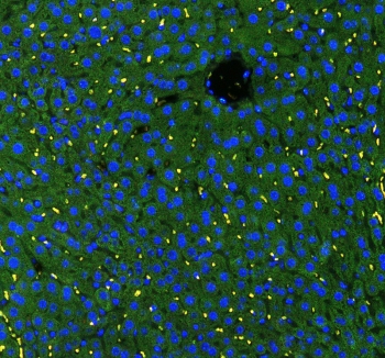 Immunofluorescent staining of FFPE mouse liver with GSTA antibody (green) at 1ug/ml and DAPI nuclear stain (blue). HIER: boil tissue sections in pH6, 10mM citrate buffer, for 10-20 min and allow to cool before testing.