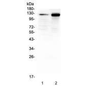 Western blot testing of 1) rat spleen and 2) mouse spleen lysate with CD41 antibody. Expected molecular weight ~120 kDa.
