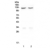 Western blot testing of human 1) HEK293 and 2) HepG2 cell lysate with CD41 antibody. Expected molecular weight ~120 kDa.