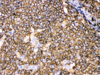 IHC testing of FFPE human tonsil with CD45 antibody. HIER: Boil the paraffin secti
