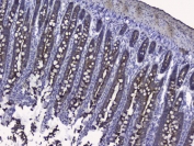 IHC testing of FFPE rat small intestine with CK19 antibody. HIER: Boil the paraffin sections in pH 6, 10mM citrate buffer for 20 minutes and allow to cool prior to staining.