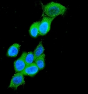 Immunofluorescent staining of FFPE human MCF7 cells with CK19 antibody (green) and DAPI nuclear stain (blue). HIER: steam section in pH6 citrate buffer for 20 min.