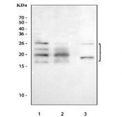 Western blot testing of 1) human HeLa, 2) human SK-O-V3 and 3) rat lung tissue lysate with FGF2 antibody. Predicted molecular weight ~31/23/17/21 kDa (isoforms 1/2/3/4).