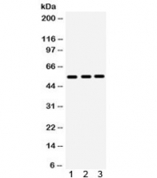 Western blot testing of 1) human placenta, 2) HeLa and 3) SGC lysate with MMP10 antibody. Expected molecular weight ~54 kDa.