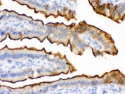 IHC testing of FFPE mouse intestine with Villin antibody. HIER: Boil the paraffin sections in pH 6, 10mM citrate buffer for 20 minutes and allow to cool prior to staining.