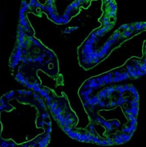 Immunofluorescent staining of FFPE human colon with Villin antibody (green) and DAPI (blue). HIER: boil tissue sections in pH6, 10mM citrate buffer, for 20 min and allow to cool before testing.