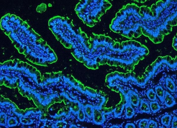Immunofluorescent staining of FFPE rat intestine with Villin antibody (green) and DAPI (blue). HIER: boil tissue sections in pH6, 10mM citrate buffer, for 20 min and allow to cool before testing.
