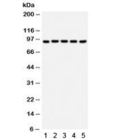 Western blot testing of 1) rat intestine, 2) mouse kidney, 3) human RH35, 4) HepG2 and 5) MCF7 lysate with Villin antibody. Expected/observed molecular weight ~93 kDa.