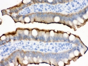 IHC testing of FFPE rat intestine with Villin antibody. HIER: Boil the paraffin sections in pH 6, 10mM citrate buffer for 20 minutes and allow to cool prior to staining.