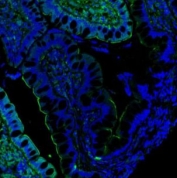 Immunofluorescent staining of FFPE human ileum with Villin antibody (green) and DAPI (blue). HIER: boil tissue sections in pH6, 10mM citrate buffer, for 20 min and allow to cool before testing.