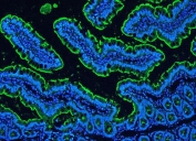 Immunofluorescent staining of FFPE rat intestine with Villin antibody (green) and DAPI (blue). HIER: boil tissue sections in pH6, 10mM citrate buffer, for 20 min and allow to cool before testing.