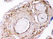 IHC testing of FFPE human placenta with Galectin 1 antibody. HIER: Boil the paraffin sections in pH 6, 10mM citrate buffer for 20 minutes and allow to cool prior to staining.