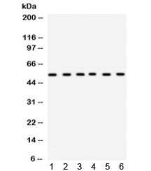 Western blot testing of 1) rat brain, 2) rat liver, 3) rat testis, 4) mouse ovary, 5) human HeLa and 6) SMMC lysate with DLD antibody. Predicted/observed molecular weight ~54 kDa.