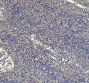 IHC staining of FFPE human spleen tissue with G-CSF antibody. HIER: boil tissue sections in pH8 EDTA for 20 min and allow to cool before testing.