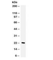 Western blot testing of human HeLa cell lysate with GCSF antibody. Expected/observed molecular weight ~22 kDa.