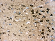 IHC testing of FFPE mouse brain with PGP 9.5 antibody. HIER: Boil the paraffin sections in pH 6, 10mM citrate buffer for 20 minutes and allow to cool prior to staining.