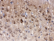 IHC testing of FFPE rat brain with PGP 9.5 antibody. HIER: Boil the paraffin sections in pH 6, 10mM citrate buffer for 20 minutes and allow to cool prior to staining.
