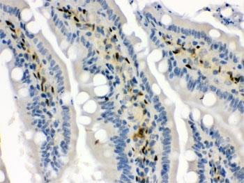 IHC testing of FFPE rat intestine with HSP70 antibody. HIER: Boil the paraffin sections in pH 6, 10mM citrate buffer for 20 minutes and allow to cool prior to staining.
