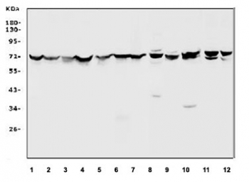 Western blot testing of human 1) HeLa, 2) A549, 3) HepG2, 4) Caco-2, 5) SW620, 6) PANCC-1, 7) Raji, 8) rat brain, 9) rat kidney, 10) mouse kidney, 11) mouse NIH 3T3 and 12) mouse RAW264.7 cell lysate with HSP70 antibody. Expected molecular weight ~70 kDa.