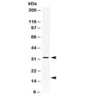Western blot testing of HeLa cell lysate with IL-8 antibody. Expected molecular weight: ~8 kDa (monomer), ~16 kDa (dimer), ~32 kDa (oligomer).