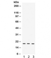 Western blot testing of mouse 1) brain, 2) thymus and 3) NIH3T3 lysate with IL-7 antibody. Expected molecular weight: 19-30 kDa depending on glycosylation level.