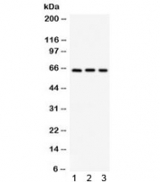 Western blot testing of 1) mouse pancreas, 2) human Jurkat and 3) human HepG2 lysate with SPP1 antibody. Expected/observed molecular weight: 35/60-65 kDa (unmodified/glycosylated).