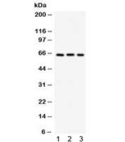 Western blot testing of 1) mouse pancreas, 2) human Jurkat and 3) human HepG2 lysate with SPP1 antibody. Expected/observed molecular weight: 35/60-65 kDa (unmodified/glycosylated).
