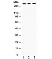 Western blot testing of human 1) HeLa, 2) A431 and 3) A549 cell lysate with PTPRF antibody. Observed molecular weight ~240 kDa.