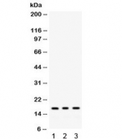 Western blot testing of 1) rat liver, 2) mouse liver, 3) human HepG2 lysate with MGST1 antibody. Expected/observed molecular weight ~17 kDa.