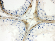 IHC testing of FFPE human testis with CLU antibody. HIER: Boil the paraffin sections in pH 6, 10mM citrate buffer for 20 minutes and allow to cool prior to staining.