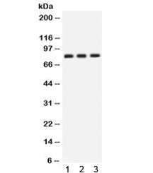 Western blot testing of human 1) SKOV, 2) U87 and 3) PANC cell lysate with CLU antibody. Predicted molecular weight: 75-80 kDa (heterodimer precursor), 36-39 kDa (alpha subunit), 34-36 kDa (beta subunit).~
