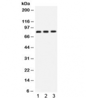 Western blot testing of human 1) SKOV, 2) U87 and 3) PANC cell lysate with CLU antibody. Predicted molecular weight: 75-80 kDa (heterodimer precursor), 36-39 kDa (alpha subunit), 34-36 kDa (beta subunit).