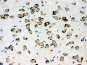 IHC testing of FFPE mouse brain with GRP78 antibody. HIER: Boil the paraffin sections in pH 6, 10mM citrate buffer for 20 minutes and allow to cool prior to staining.