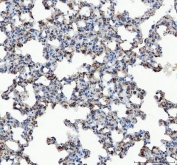 IHC staining of FFPE rat lung tissue with GRP78 antibody. HIER: boil tissue sections in pH8 EDTA for 20 min and allow to cool before testing.