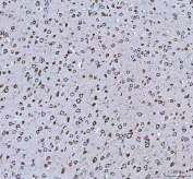 IHC staining of FFPE rat brain tissue with GRP78 antibody. HIER: boil tissue sections in pH8 EDTA for 20 min and allow to cool before testing.