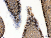 IHC testing of FFPE mouse testis with GRP78 antibody. HIER: Boil the paraffin sections in pH 6, 10mM citrate buffer for 20 minutes and allow to cool prior to staining.