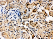 IHC testing of FFPE mouse kidney with HSC70 antibody. HIER: Boil the paraffin sections in pH 6, 10mM citrate buffer for 20 minutes and allow to cool prior to staining.