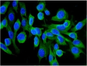 Immunofluorescent staining of FFPE human U-2 OS cells with HSC70 antibody (green) and DAPI nuclear stain (blue). HIER: steam section in pH6 citrate buffer for 20 min.