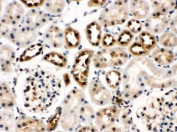 IHC testing of FFPE rat kidney with HSC70 antibody. HIER: Boil the paraffin sections in pH 6, 10mM citrate buffer for 20 minutes and allow to cool prior to staining.