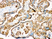 IHC testing of FFPE human placenta with SLC2A1 antibody. HIER: Boil the paraffin sections in pH 6, 10mM citrate buffer for 20 minutes and allow to cool prior to staining.