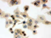 ICC testing of human A549 cells with SLC2A1 antibody.