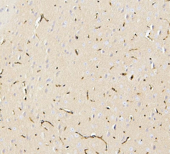 IHC testing of FFPE mouse brain with SLC2A1 antibody. HIER: Boil the paraffin sections in pH 8 EDTA for 20 minutes and allow to cool prior to staining.