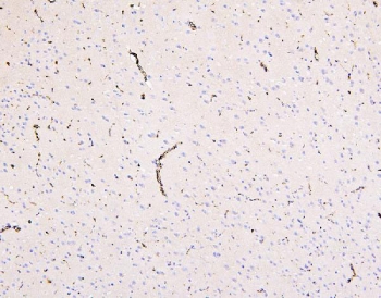 IHC testing of FFPE rat brain with SLC2A1 antibody. HIER: Boil the paraffin sections in pH 8 EDTA for 20 minutes and allow to cool prior to staining.