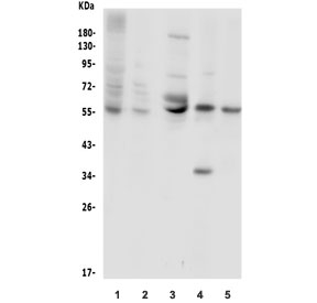 Western blot testing of 1) human placenta, 2) human A549, 3) mouse brain, 4) rat PC-12 and 5) mouse NIH 3T3 lysate wtih SLC2A1 antibody. Predicted molecular weight ~55 kDa.