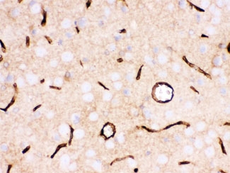 IHC testing of FFPE rat brain with SLC2A1 antibody. HIER: Boil the paraffin sections in pH 6, 10mM citrate buffer for 20 minutes and allow to cool prior to staining.