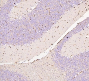 IHC testing of FFPE rat brain with SLC2A1 antibody. HIER: Boil the paraffin sections in pH 8 EDTA for 20 minutes and allow to cool prior to staining.