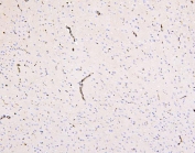 IHC testing of FFPE rat brain with SLC2A1 antibody. HIER: Boil the paraffin sections in pH 8 EDTA for 20 minutes and allow to cool prior to staining.