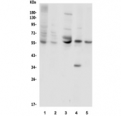 Western blot testing of 1) human placenta, 2) human A549, 3) mouse brain, 4) rat PC-12 and 5) mouse NIH 3T3 lysate wtih SLC2A1 antibody. Predicted molecular weight ~55 kDa.
