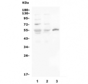 Western blot testing of 1) rat brain, 2) mouse brain and 3) mouse NIH 3T3 lysate wtih SLC2A1 antibody. Predicted molecular weight ~55 kDa.