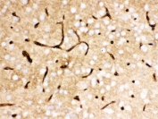 IHC testing of FFPE mouse brain with SLC2A1 antibody. HIER: Boil the paraffin sections in pH 6, 10mM citrate buffer for 20 minutes and allow to cool prior to staining.